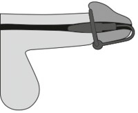 Penisplug mit Silikon-Eichelring von Penisplug