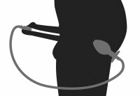 PPlug Penetration Set